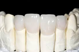 Sứ Ceramill Zi